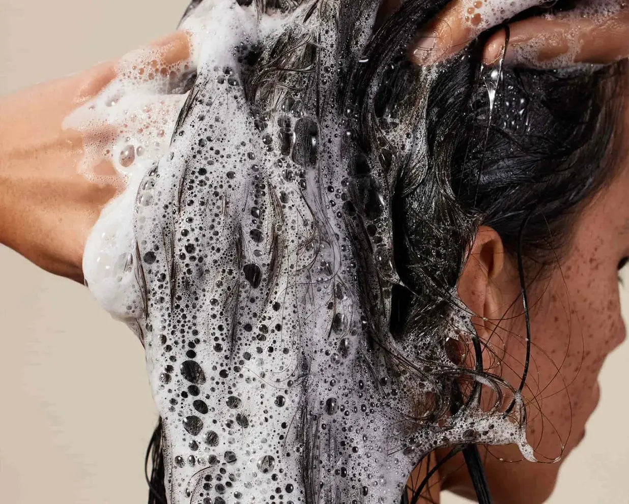 Hormones & Hair: Understanding Root Imbalance